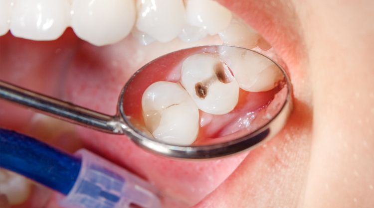 Before - Wash Common Dental