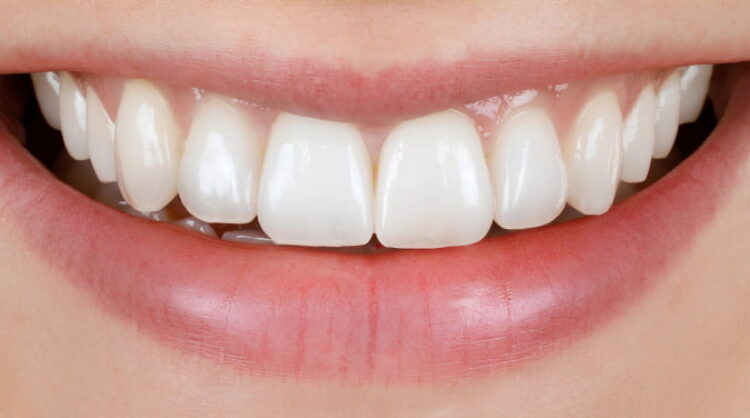 After -Wash Common Dental