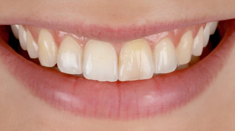 Before - Wash Common Dental