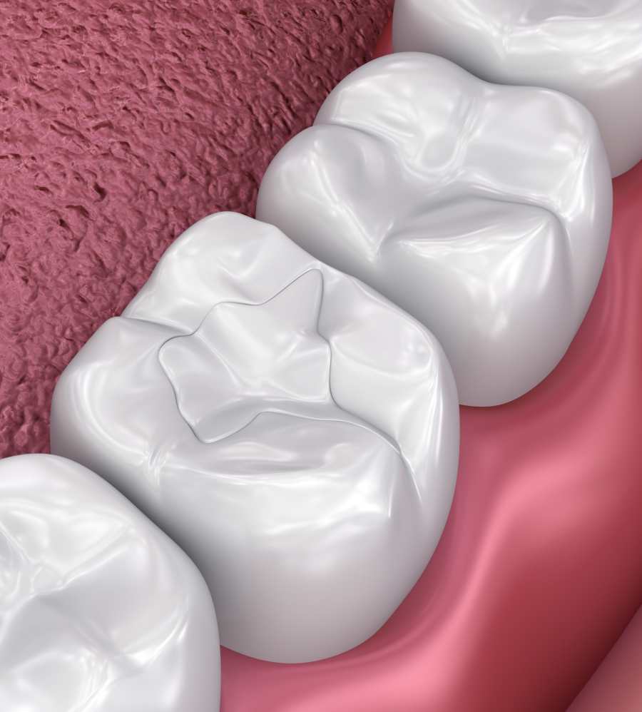 Wash Common Dental