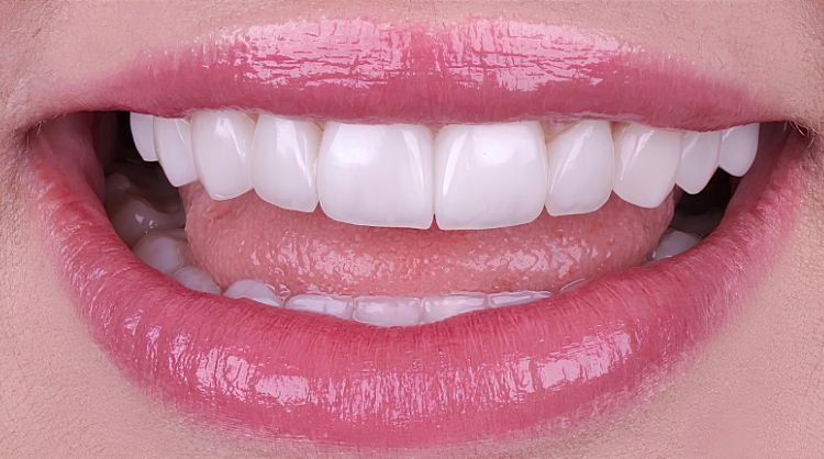 After -Wash Common Dental