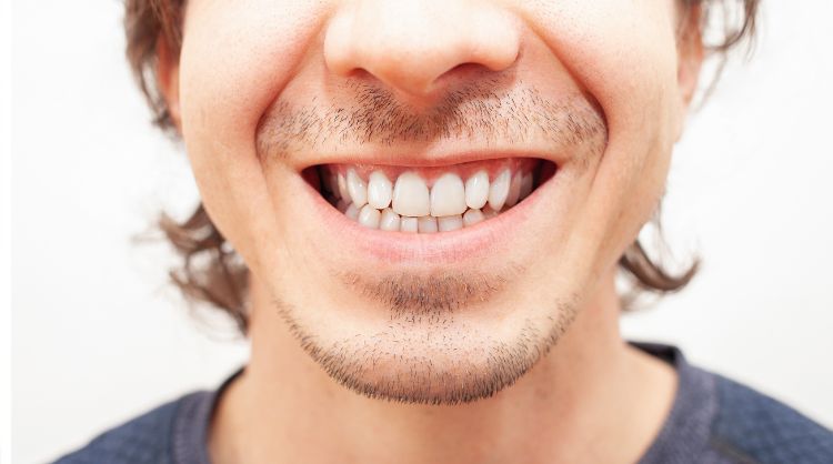 After -Wash Common Dental