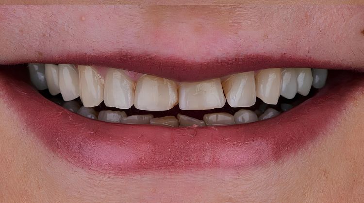 Before - Wash Common Dental