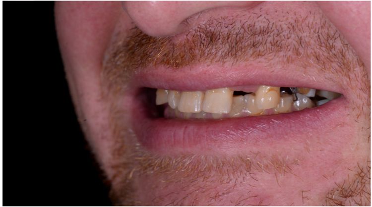 Before - Wash Common Dental